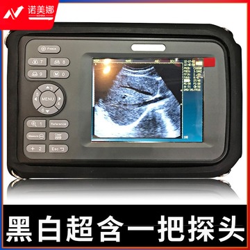 远燕/YUAN YAN b超机人用便携式彩色黑白超掌上孕妇看男女高清检孕仪孕诊断 XF30 笔记本型+腹部探头 安全用仪器